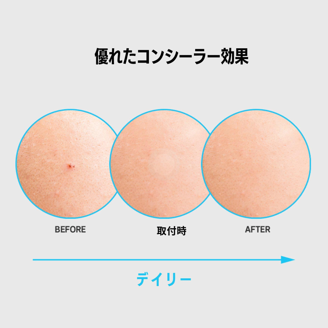【NOLAHOUR】スポットイレイザー ブルー ハイドロコロイドパッチ Step2 (63枚入り) / ニキビパッチ ※9/17-23より順次発送予定