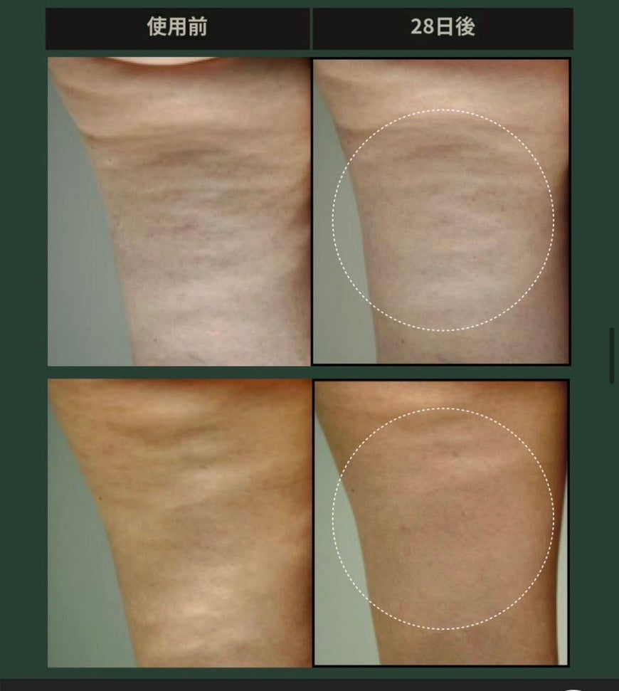 【特典付き🎁】【SUELO】 VOLCANO BODY SLIMMING PPC CREAM 120ml (マッサージクリーム) ※7/8〜7/19迄に順次発送予定