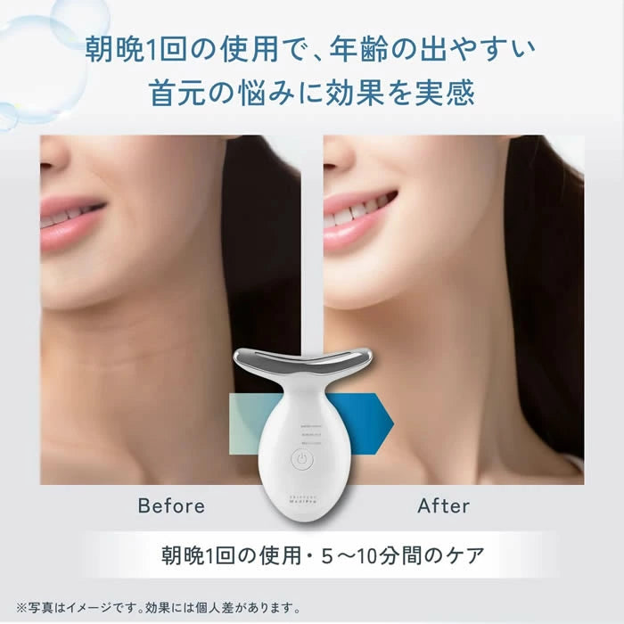 【KYOGOKU ★豪華特典付き】Skin Sync MediPro(スキンソニックメディプロ) 美顔器 ※2/26〜3/4頃より順次発送