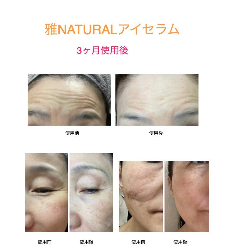 雅｜Miyabi Natural Beauty Serum　0.34g×30個　※4/16~より順次発送予定