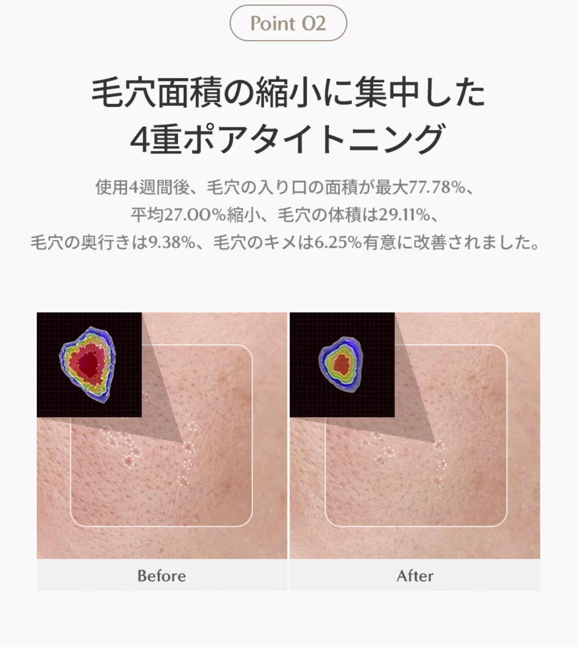 【DEMAR3】シグネチャーエストゥードプロテクター5.2　※1/14-20頃より配送予定