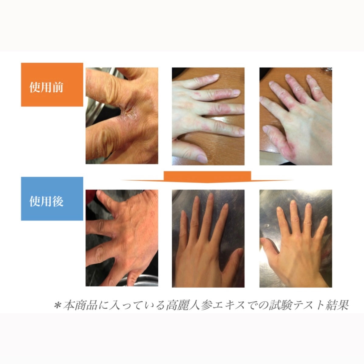 【革命的👀おすすめ品】be-unfee ハンドクリーム  使用期限切れ　※6/11-17頃より順次発送